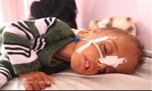 ۷۴۹۵ شهید و ۱۶۰۵۸ زخمی از ابتدای تجاوز عربستان به یمن تاکنون