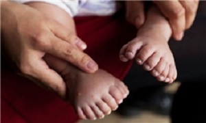 تلاش پزشکان چینی برای حذف انگشتان اضافی نوزاد ۳۱ انگشتی + تصاویر