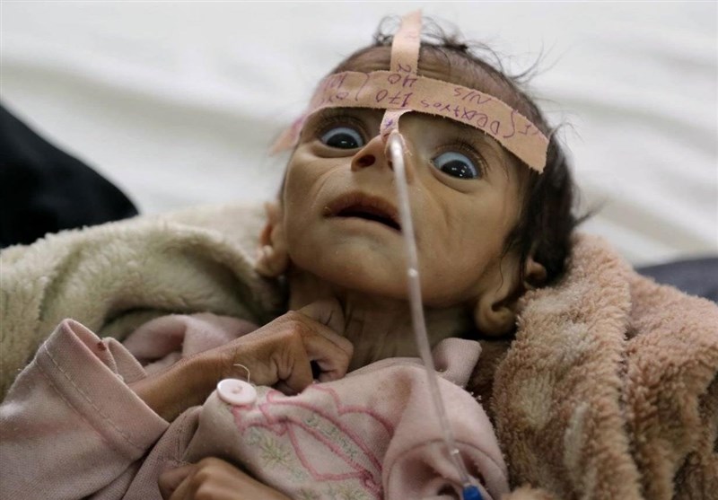 هشدار سازمان بهداشت جهانی نسبت به موج جدید “وبا” در یمن