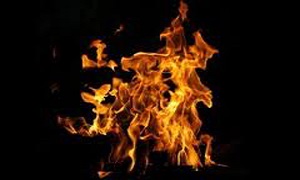 کودک ۲ ساله در آتش سوخت