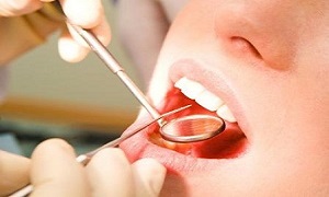 احتمال ابتلا به ایدز و هپاتیت بر اثر سهل انگاری در دندانپزشکی