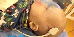 خارج کردن سه‌شاخه کابل برق از سر یک کودک ۲ ساله +عکس