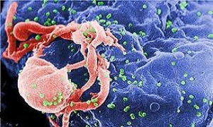 واکسن بیماری ابولا ساخته شد