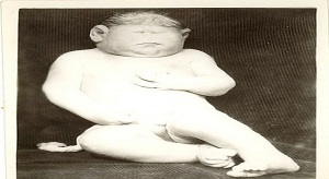 عجیب و غریب ترین کودکان قرن ۱۹ + تصاویر