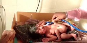 تولد نوزاد چهار پا در هندوستان + تصاویر