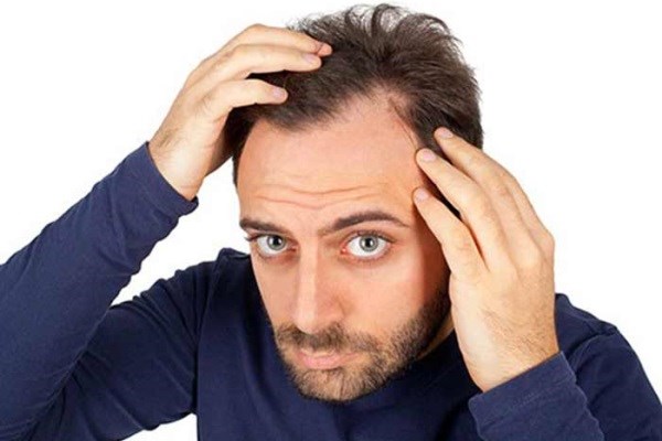 ۴۰ دلیل شایع ریزش مو + راهکار‌های درمانى